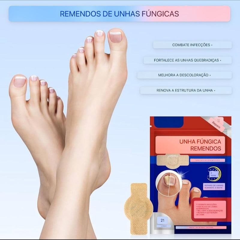 Adesivos Antifúngicos Para Tratamento De Unhas , Reparos De Onicomicose - Sempre Acessível