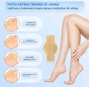 Adesivos Antifúngicos Para Tratamento De Unhas , Reparos De Onicomicose - Sempre Acessível