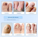 Adesivos Antifúngicos Para Tratamento De Unhas , Reparos De Onicomicose - Sempre Acessível